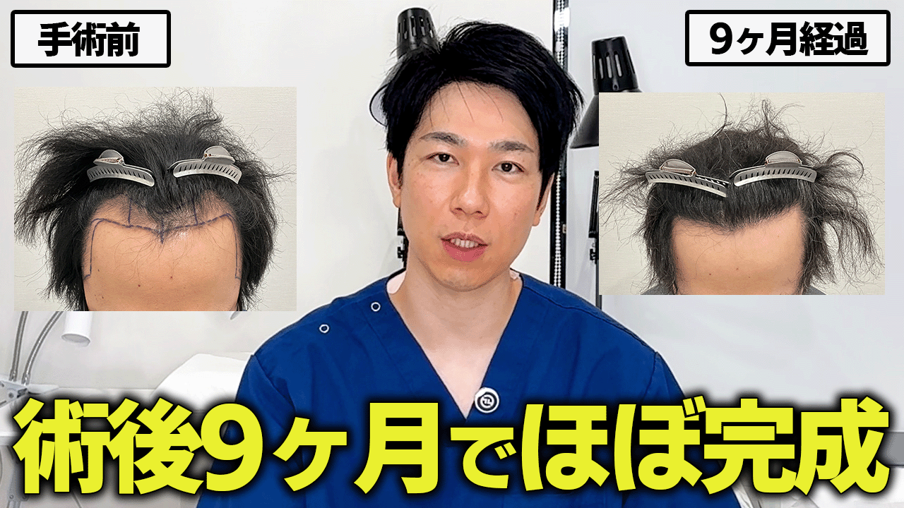 30代男性 2011株 9ヶ月