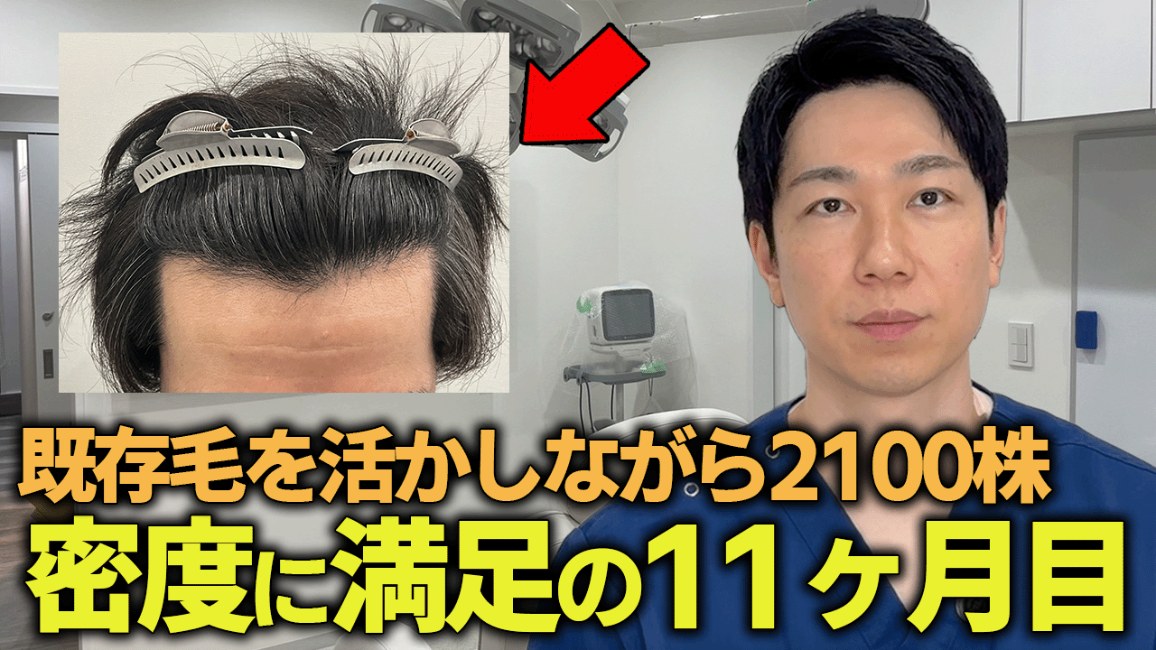 11-v2サムネイル