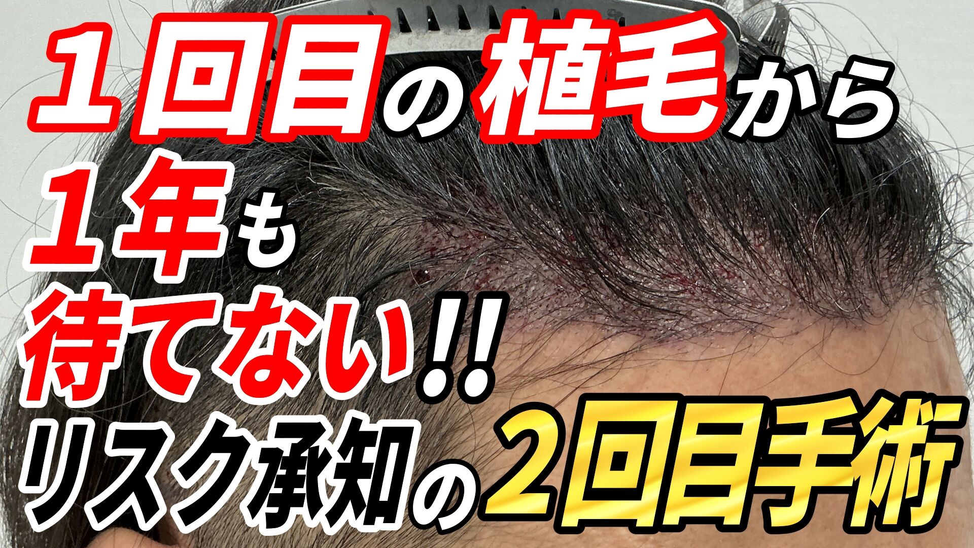 125_40代男性_サムネイル