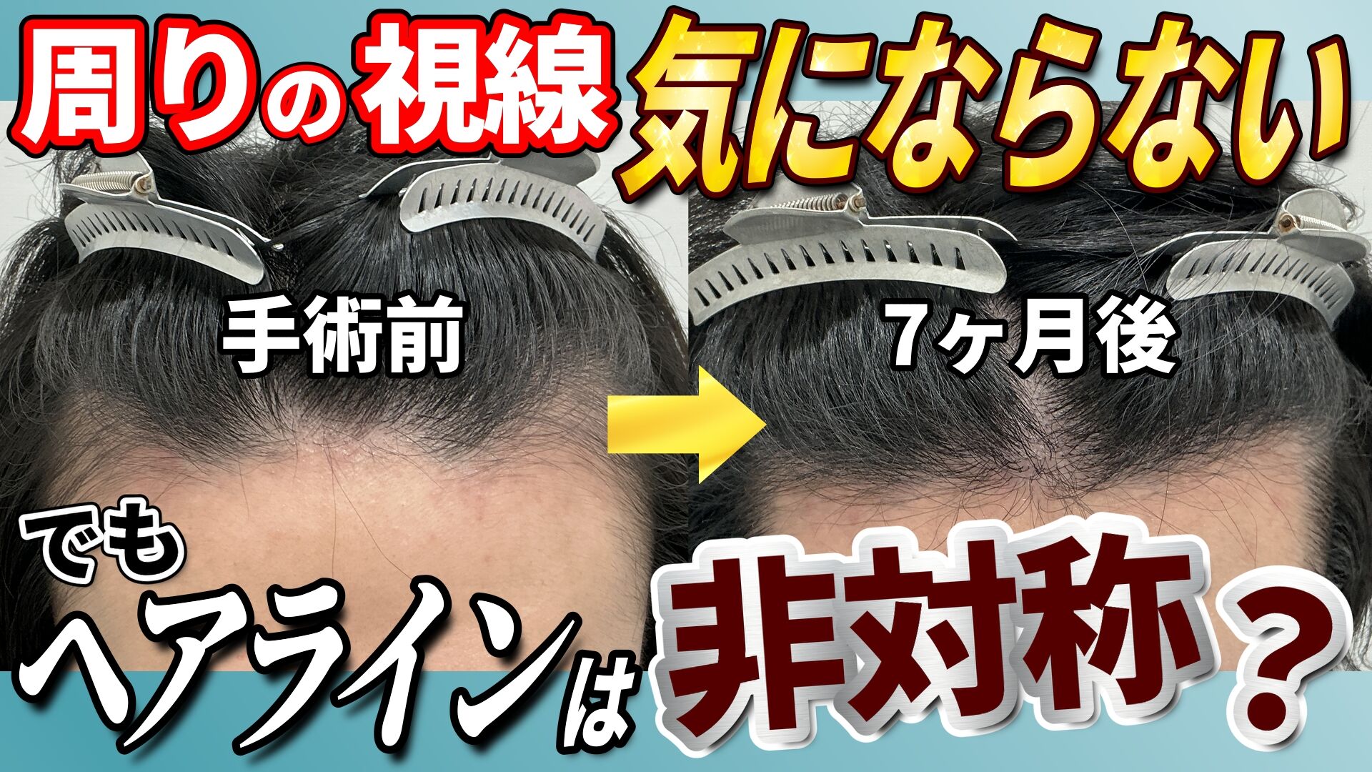 129_20代男性_サムネイル