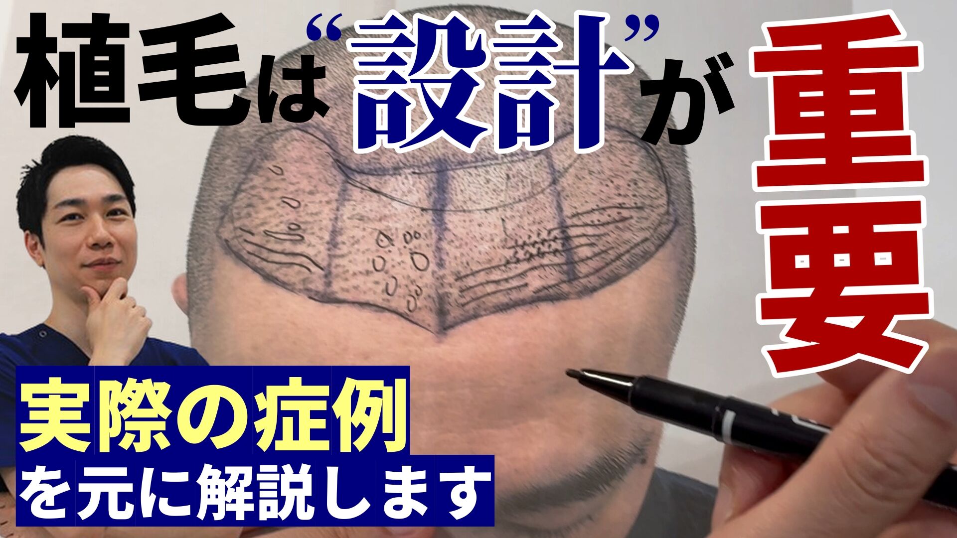 136_サムネイル②