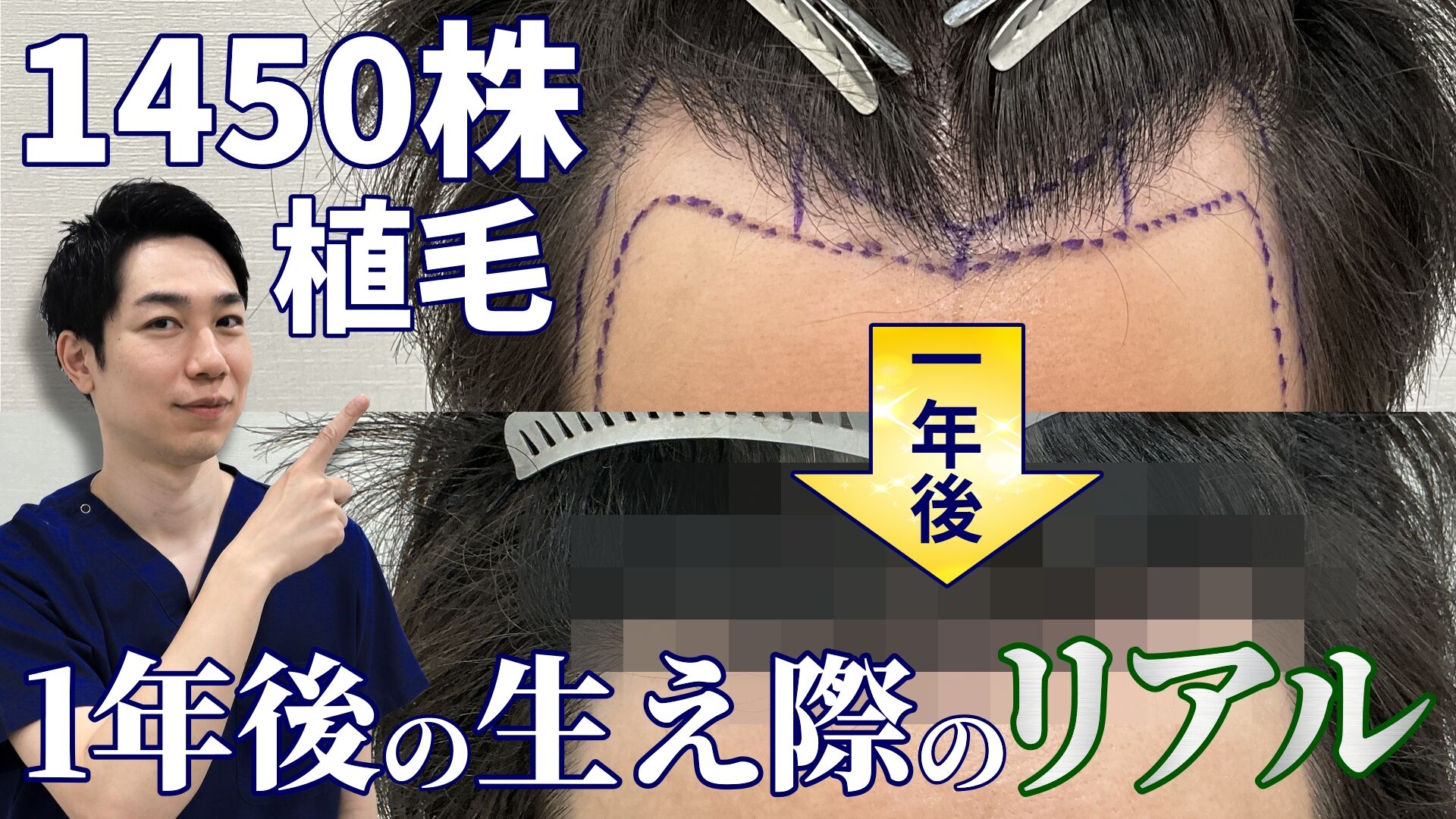 140_サムネイル①