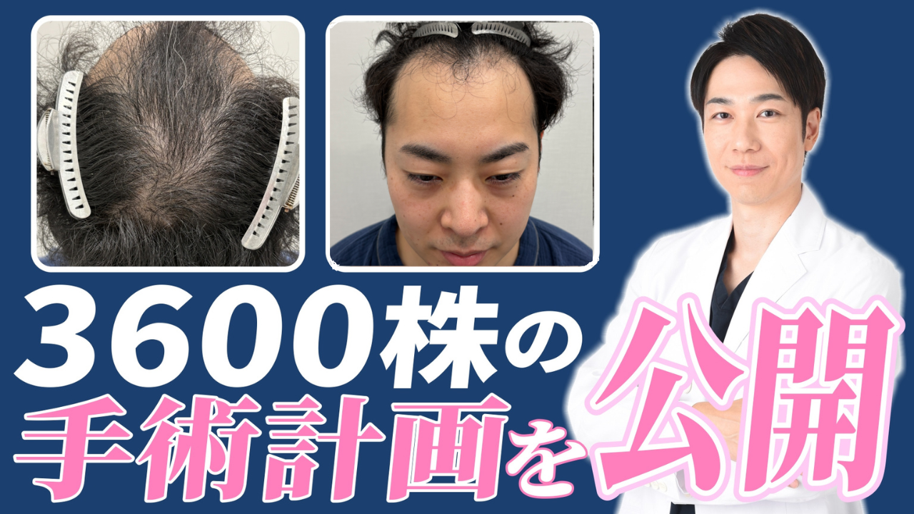No.153サムネ