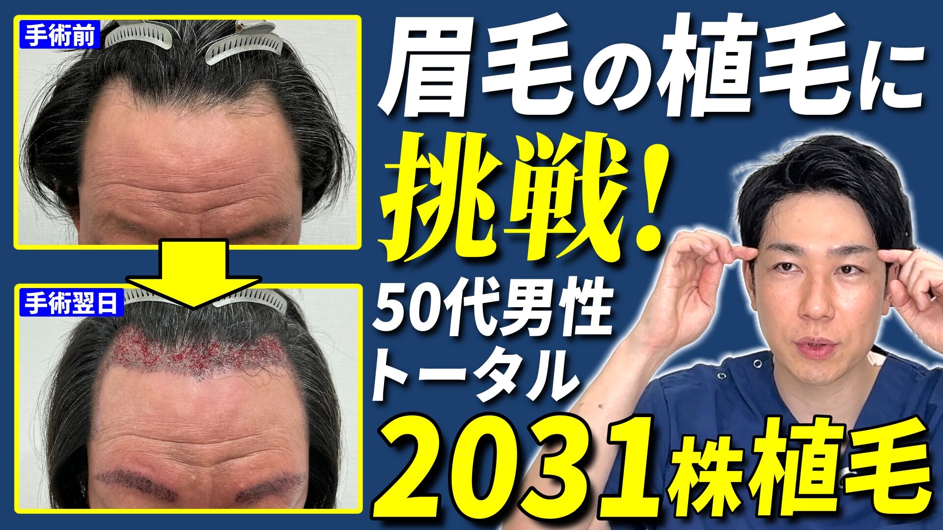 上原6_サムネイル (1)