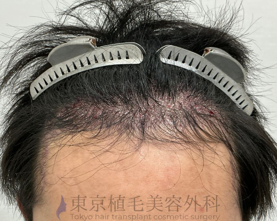 １枚 (2)翌日