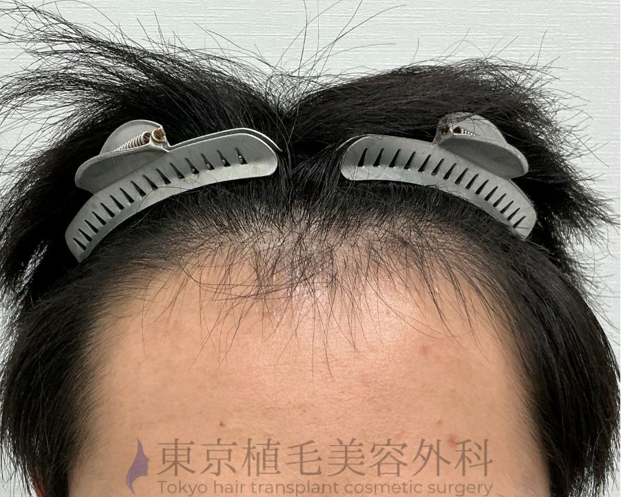 １枚 (1)前