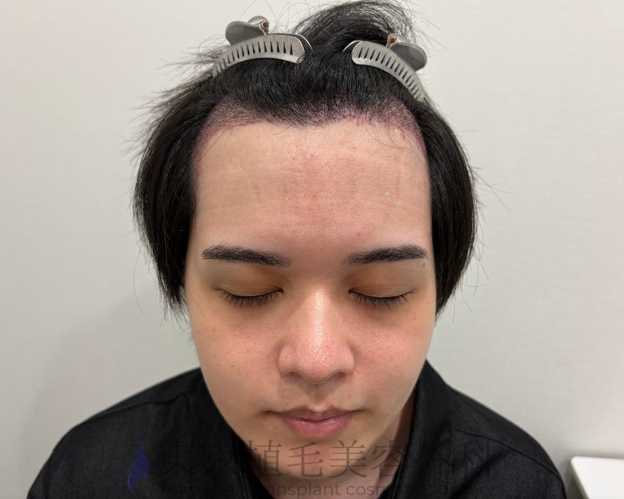 １枚 (2)