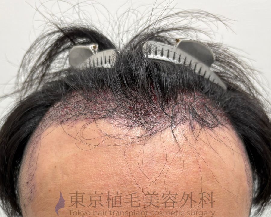 １枚 (4)　小曽根様翌日