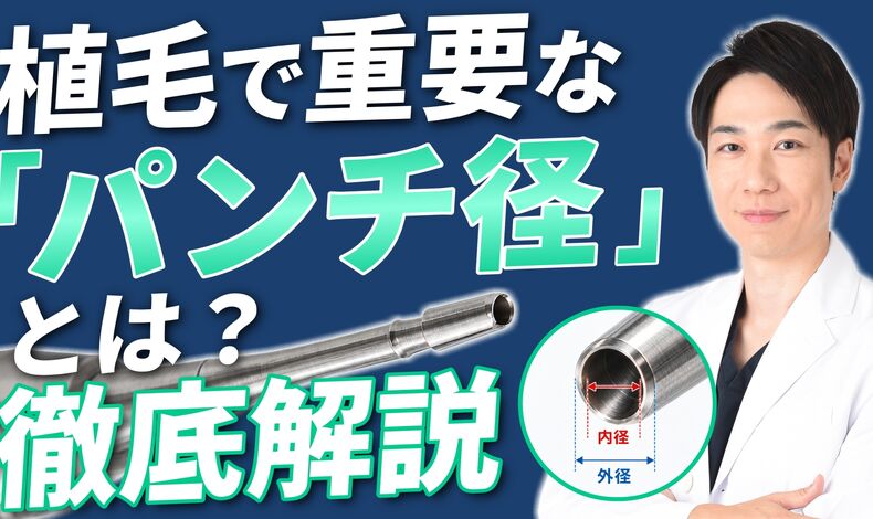 画像4376：FUE植毛におけるパンチ径について解説したYouTubeが公開されました