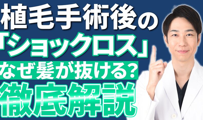画像4406：自毛植毛のショックロスについて解説した動画がYouTubeで公開されました