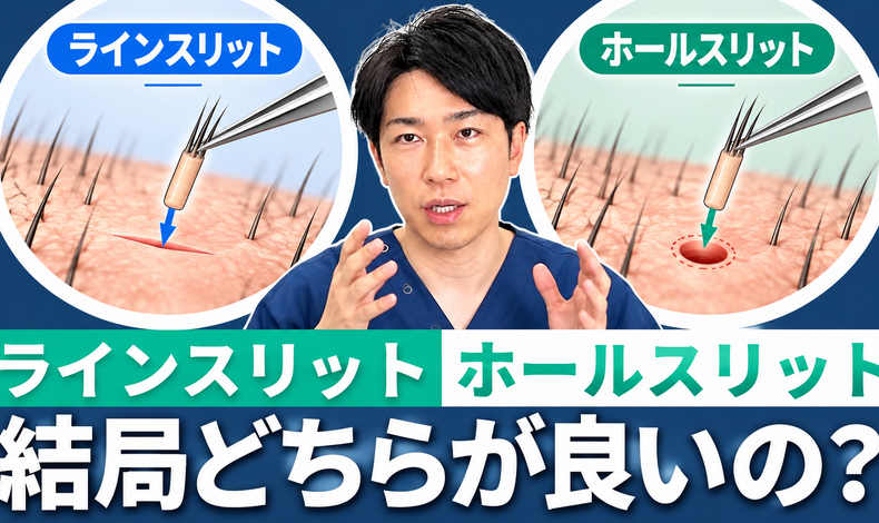 画像4423：ラインスリットとホールスリットについて佐藤院長が解説したYouTube動画が公開されました