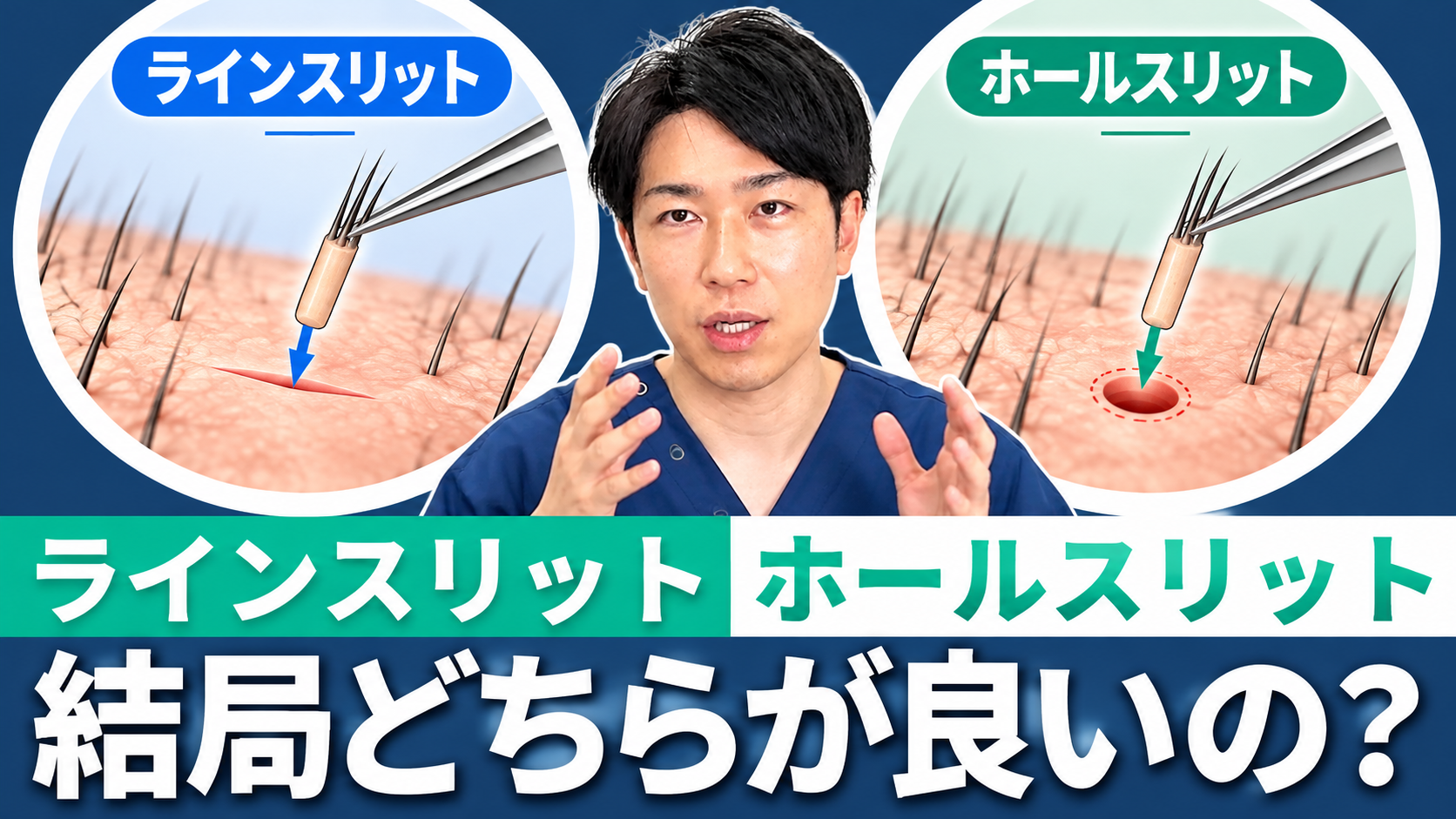 ラインスリットとホールスリット比較