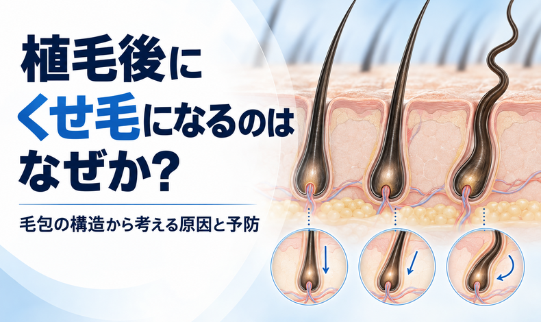 画像4492：植毛後にくせ毛になるのはなぜか？―毛包の構造から考える原因と予防