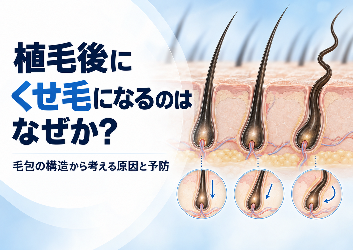 画像4492